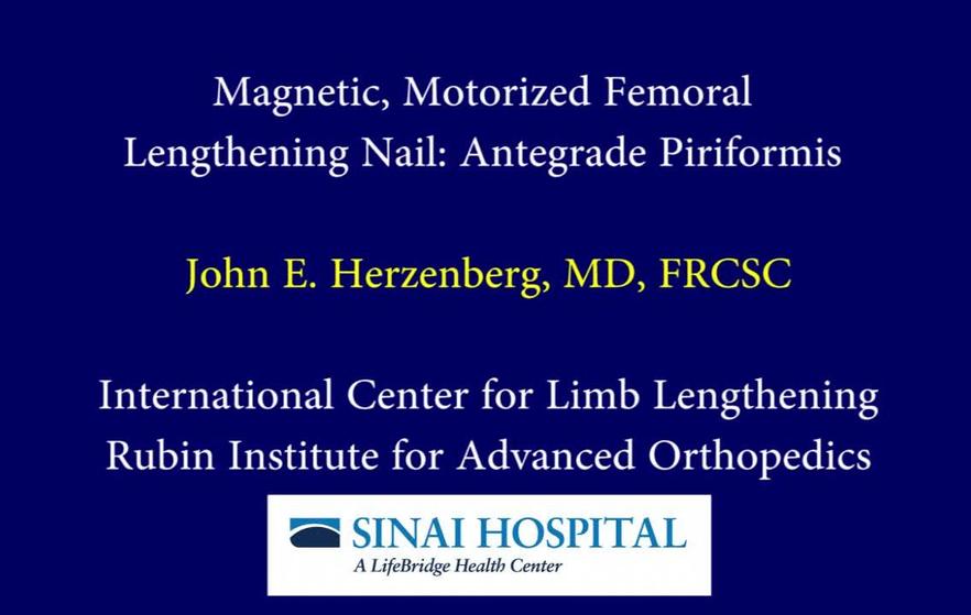 Implant Identification Orthopaediclist Com