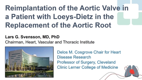 Thumbnail for entry Reimplantation of the Aortic Valve in a Patient with Loeys-Dietz in the Replacement of the Aortic Root (Short version)