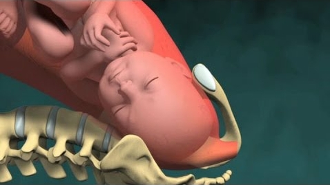 Thumbnail for Normal Vaginal Childbirth