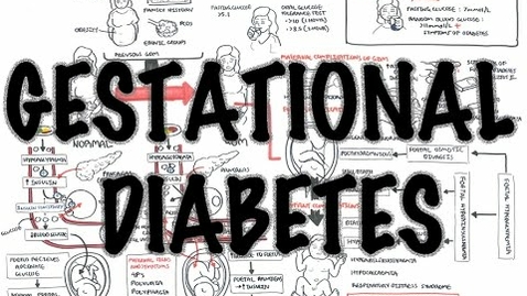 Thumbnail for Gestational Diabetes - Overview, signs and symptoms, pathophysiology, diagnosis, treatment