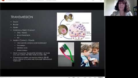 Thumbnail for entry Mono Disease Presentation