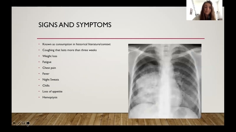Thumbnail for Tuberculosis Presentation