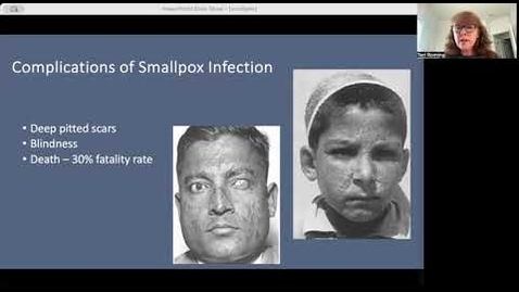 Thumbnail for Smallpox Disease Presentation
