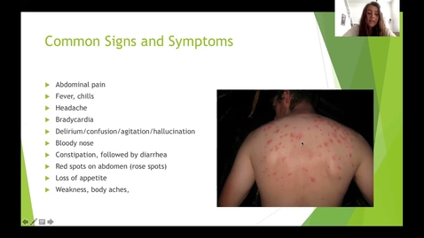 Thumbnail for Typhoid Presentation