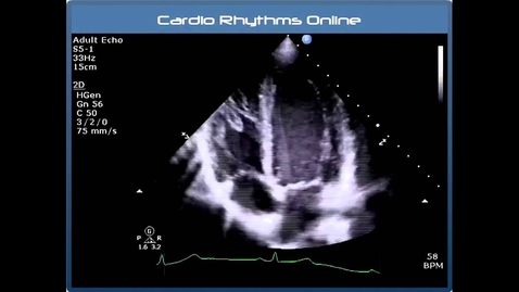 Thumbnail for Understanding Echo: Standard Imaging Views