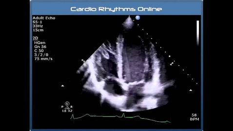 Thumbnail for entry Understanding Echo: Standard Imaging Views