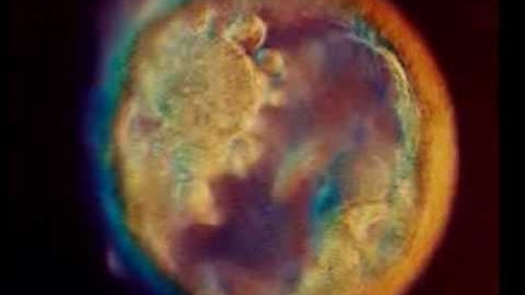 Thumbnail for Fetal Development