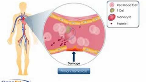 Thumbnail for entry Hemostasis