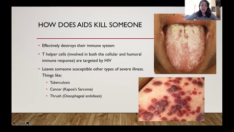 Thumbnail for entry Bio 221 HIV Disease Presentation