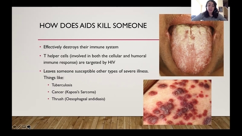 Thumbnail for Bio 221 HIV Disease Presentation