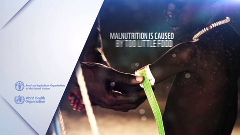 Thumbnail for What is malnutrition?