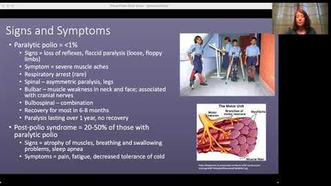 Thumbnail for Polio Presentation