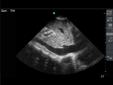 Video Gallery Emergency Medicine News