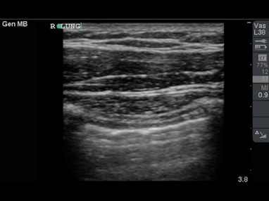 Video Gallery Emergency Medicine News