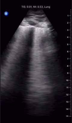 Video Gallery Anesthesia Analgesia