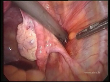 Video Gallery Obstetrics Gynecology