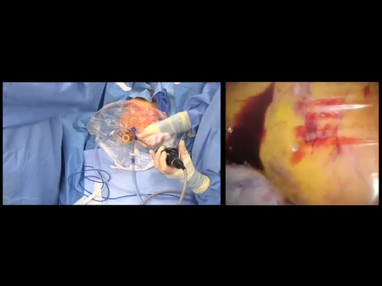 Video Gallery Obstetrics Gynecology