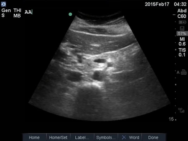 Video Gallery Emergency Medicine News