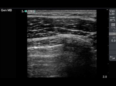 Video Gallery Emergency Medicine News
