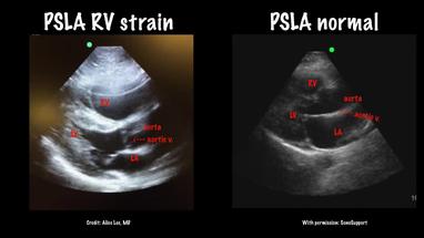 Video Gallery Emergency Medicine News