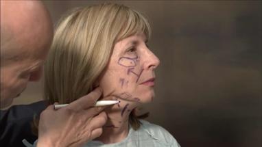 Video Gallery Plastic And Reconstructive Surgery