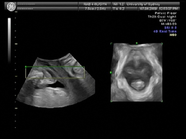 Video Gallery Obstetrics Gynecology