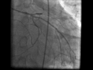 Video Gallery Emergency Medicine News