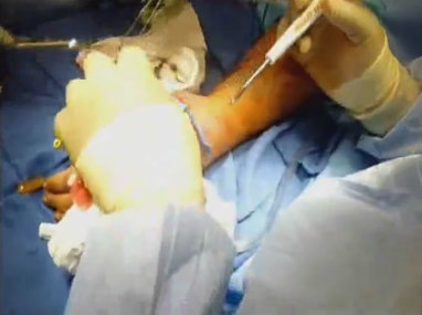 Video Gallery Plastic And Reconstructive Surgery