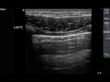 Video Gallery Emergency Medicine News
