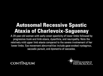 Continuum Lifelong Learning In Neurology