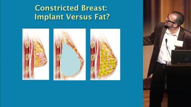 Video Gallery Plastic And Reconstructive Surgery