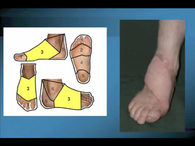 Video Gallery Plastic And Reconstructive Surgery