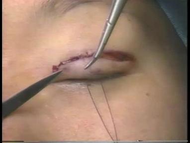 Video Gallery Plastic And Reconstructive Surgery