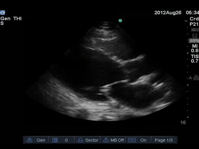 Video Gallery Emergency Medicine News
