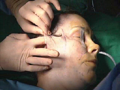Video Gallery Plastic And Reconstructive Surgery
