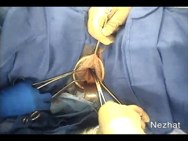 Video Gallery Obstetrics Gynecology