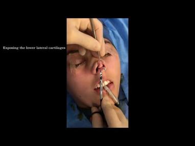 Video Gallery Plastic And Reconstructive Surgery
