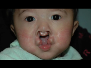 Video Gallery Plastic And Reconstructive Surgery