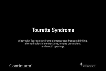 Turrets syndrome videos