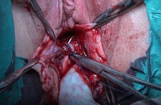 Video Gallery Obstetrics Gynecology