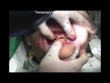 Video Gallery Plastic And Reconstructive Surgery Global Open