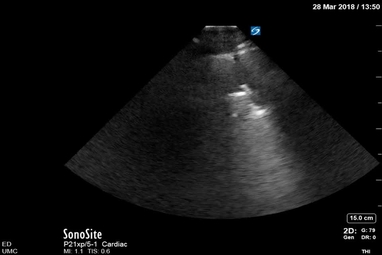Video Gallery Emergency Medicine News