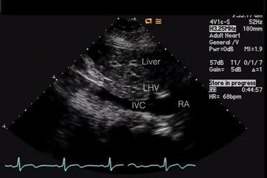 Video Gallery Anesthesia Analgesia