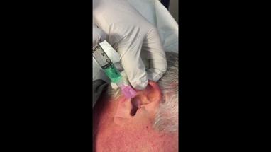 Video Gallery Emergency Medicine News