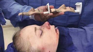 Video Gallery Plastic And Reconstructive Surgery