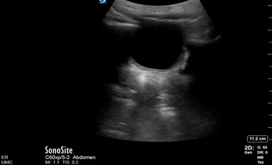 Video Gallery Emergency Medicine News