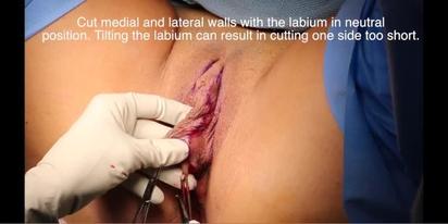 Plastic and Reconstructive Surgery – Global Open