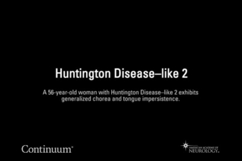 Continuum Lifelong Learning In Neurology