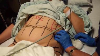 Video Gallery Plastic And Reconstructive Surgery