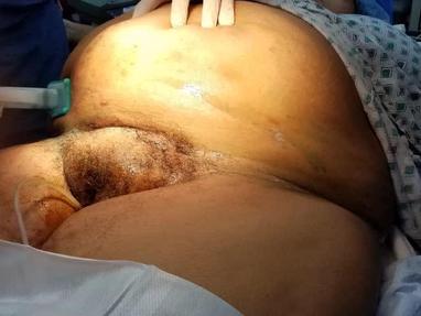 382px x 287px - Video Gallery : Obstetrics & Gynecology